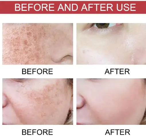 Niacinamide  Moisturizing Care Solution